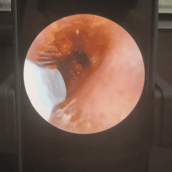 See what your ears have been hiding.